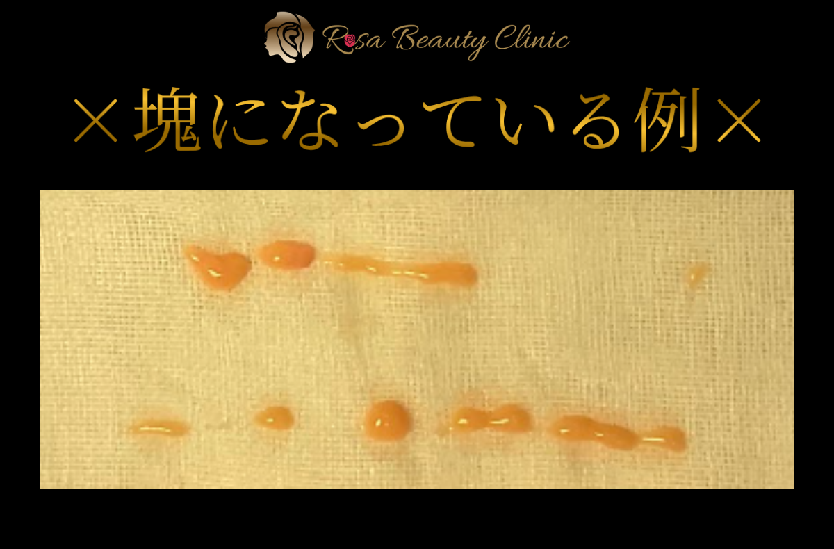 ダメな例