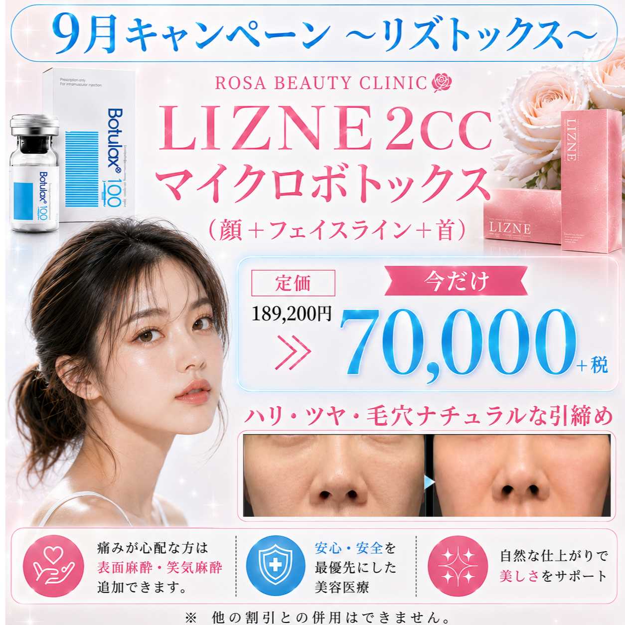 【9月キャンペーン】リズトックス　リズネ2cc＋マイクロボトックス顔＋フェイスライン＋首※キャンペーンの適応はお客様からのご申告によって適応になります。会計後のご申告は適応できかねます。※麻酔代・ポイント・会員費・物販・コース料金は含めません