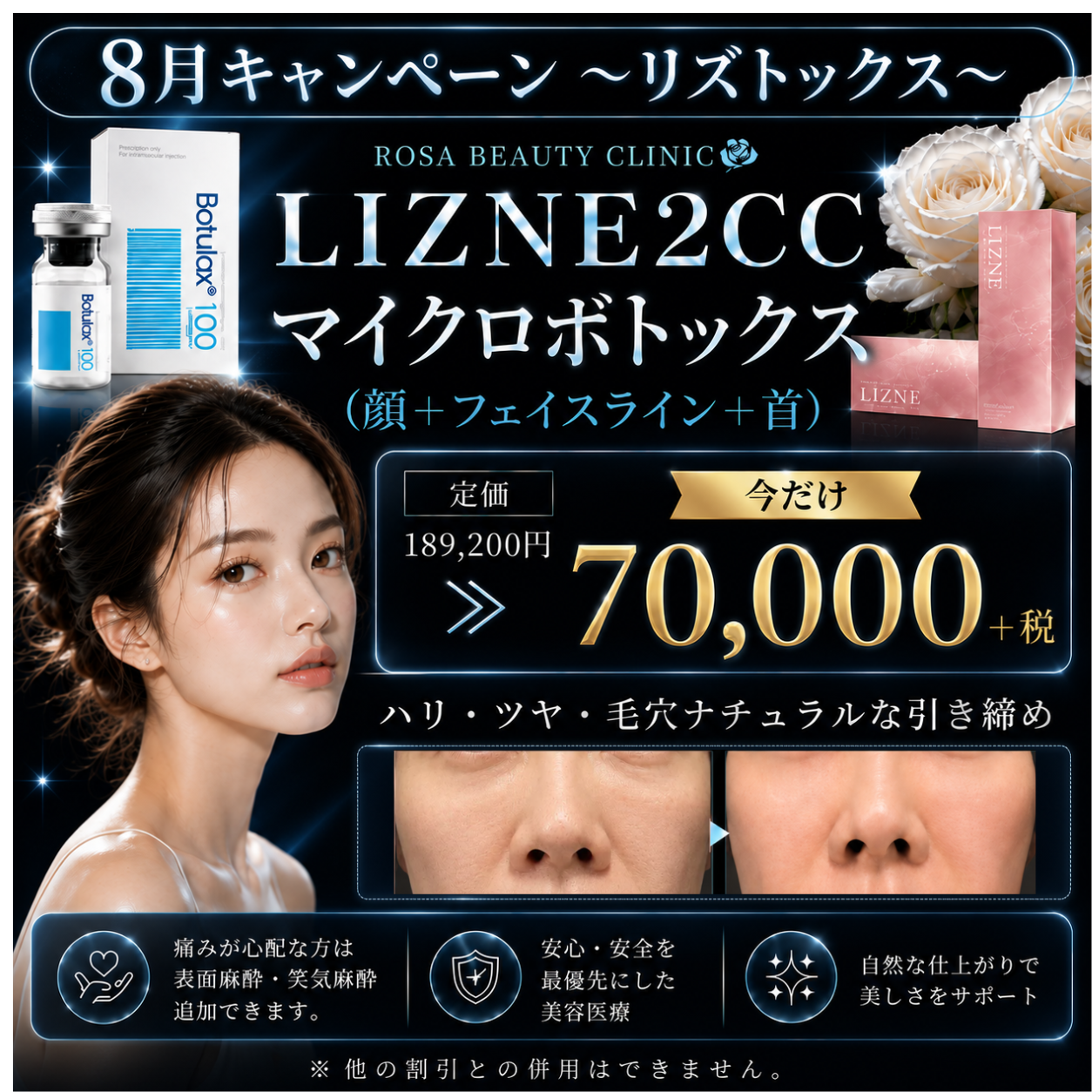 【8月キャンペーン】リズトックス　リズネ2cc＋マイクロボトックス顔＋フェイスライン＋首※キャンペーンの適応はお客様からのご申告によって適応になります。会計後のご申告は適応できかねます。